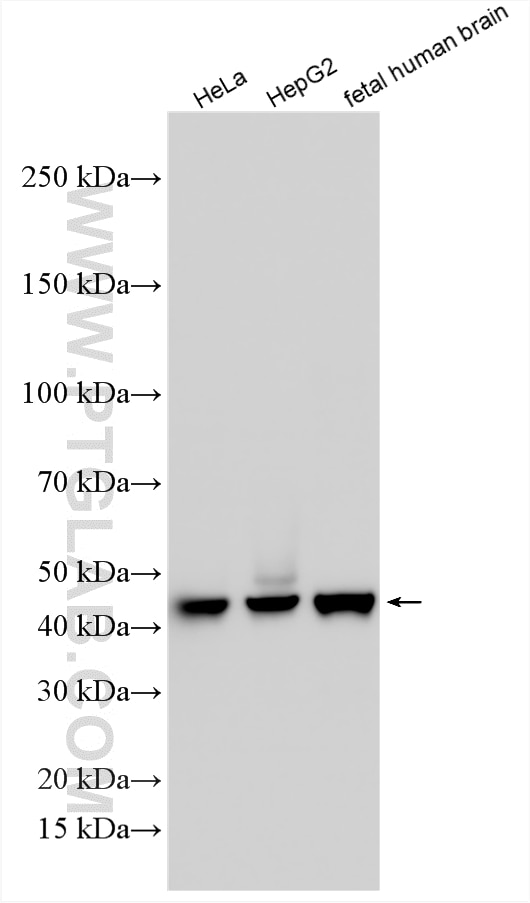 Western Blot (WB) analysis of various lysates using SNX15 Polyclonal antibody (16049-1-AP)