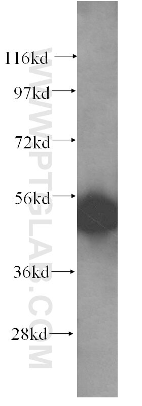 Western Blot (WB) analysis of human testis tissue using SNX15 Polyclonal antibody (16049-1-AP)