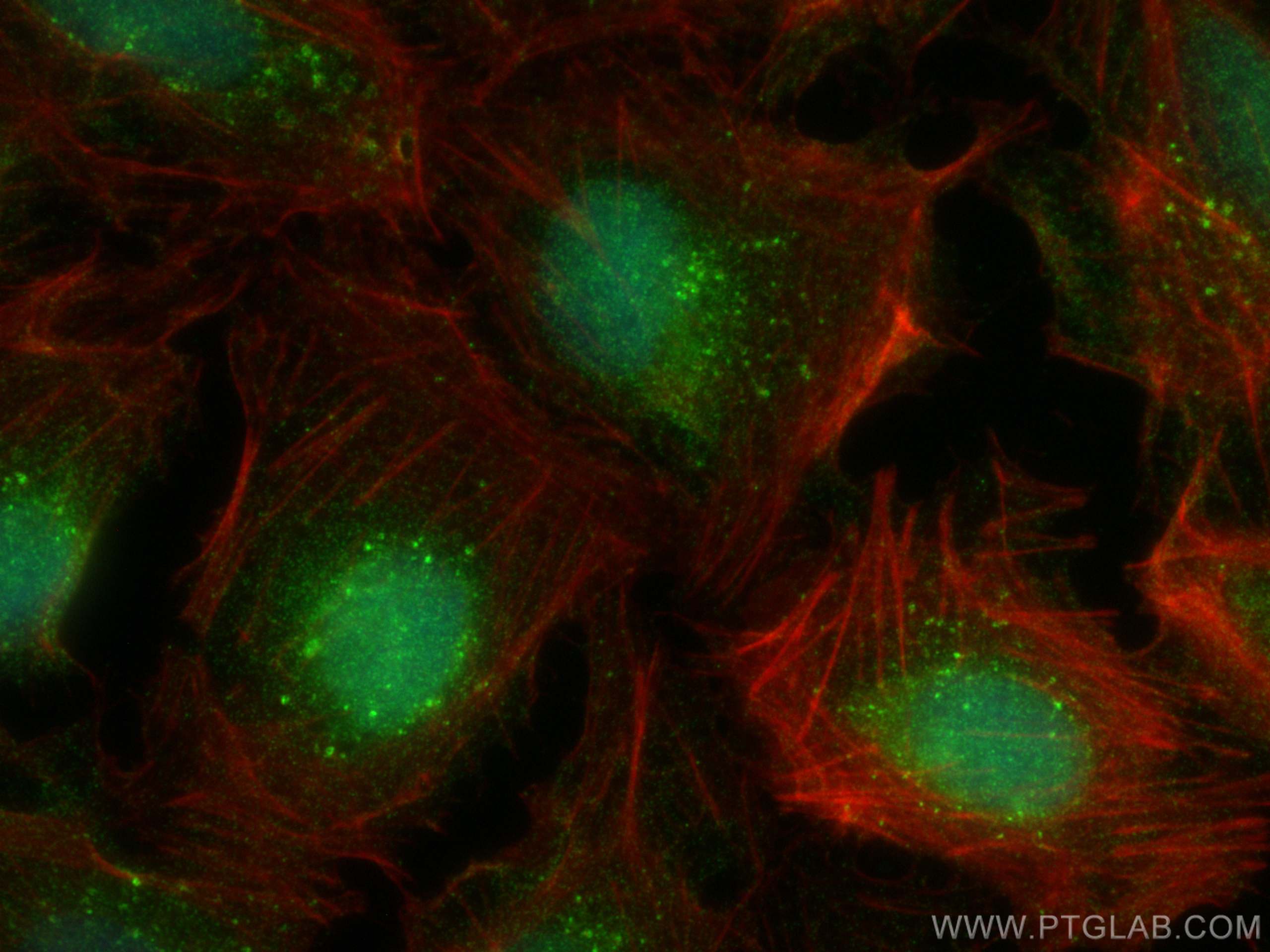 Immunofluorescence (IF) / fluorescent staining of U2OS cells using SNX15 Monoclonal antibody (68239-1-Ig)