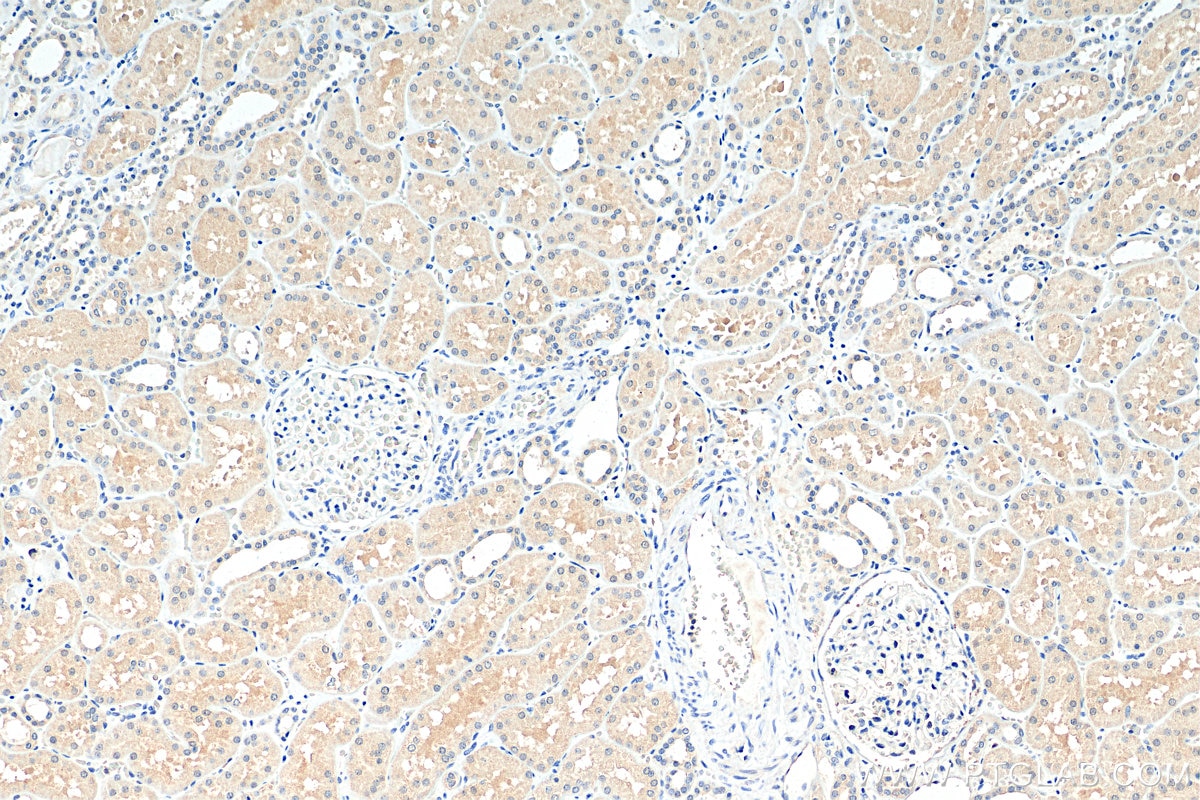 Immunohistochemistry (IHC) staining of human kidney tissue using SNX15 Monoclonal antibody (68239-1-Ig)