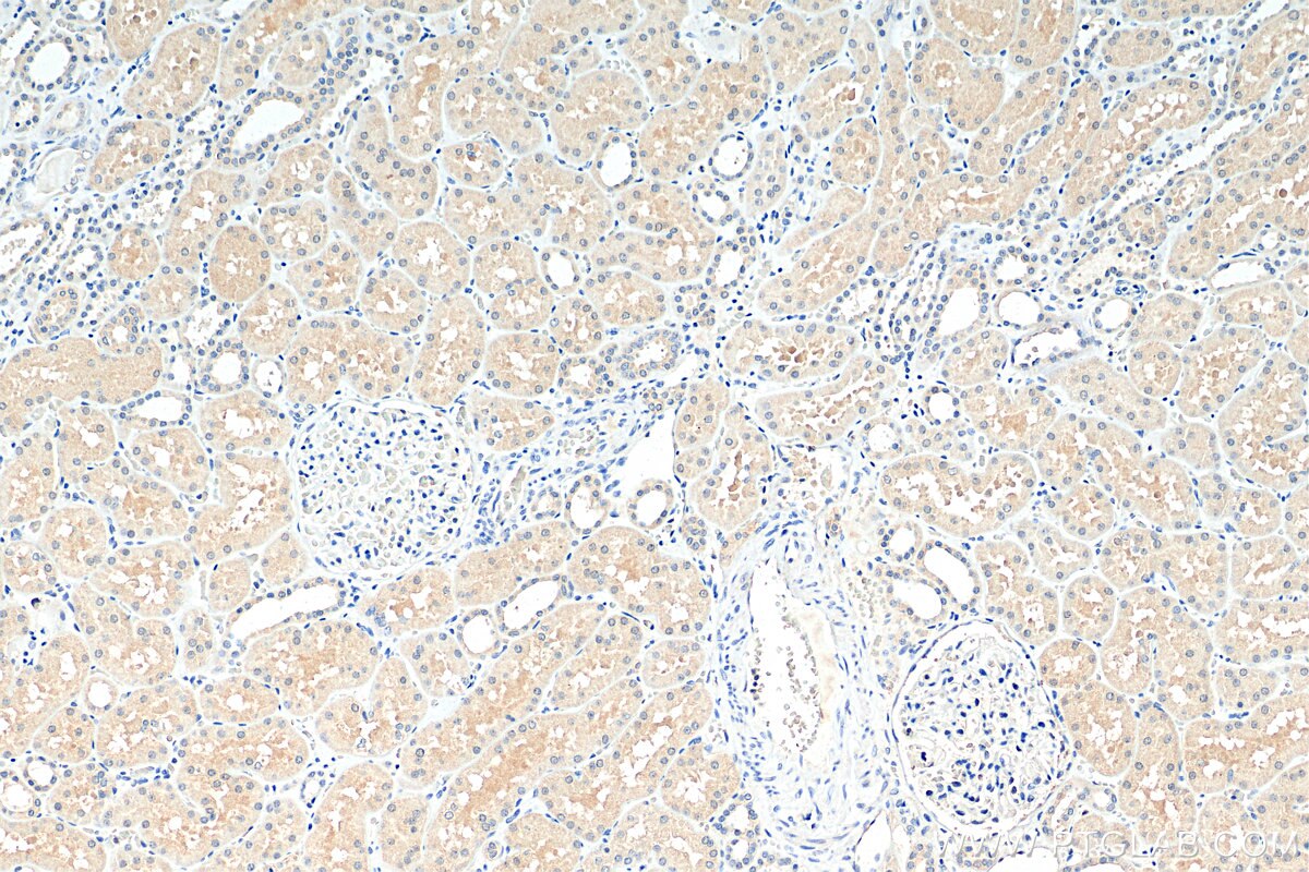 Immunohistochemistry (IHC) staining of human kidney tissue using SNX15 Monoclonal antibody (68239-1-Ig)