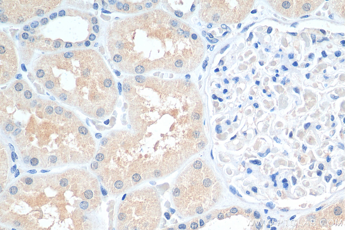 Immunohistochemistry (IHC) staining of human kidney tissue using SNX15 Monoclonal antibody (68239-1-Ig)