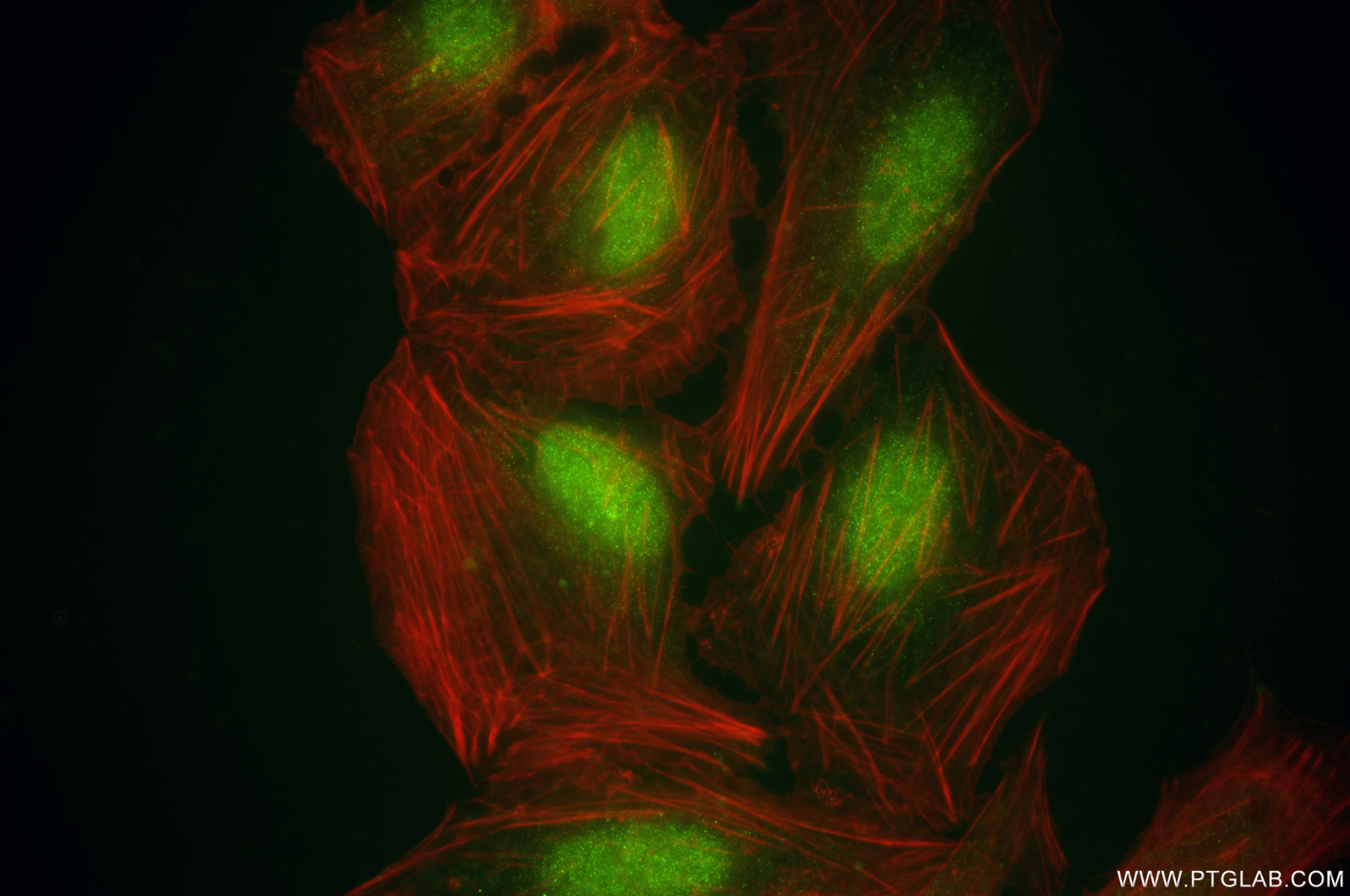 Immunofluorescence (IF) / fluorescent staining of U2OS cells using SNX15 Recombinant antibody (85909-2-RR)