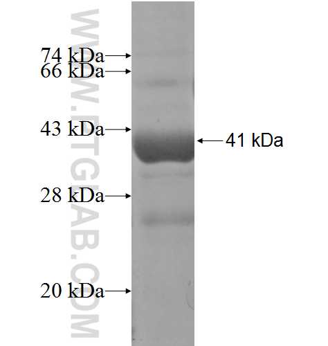 SNX16 fusion protein Ag4607 SDS-PAGE