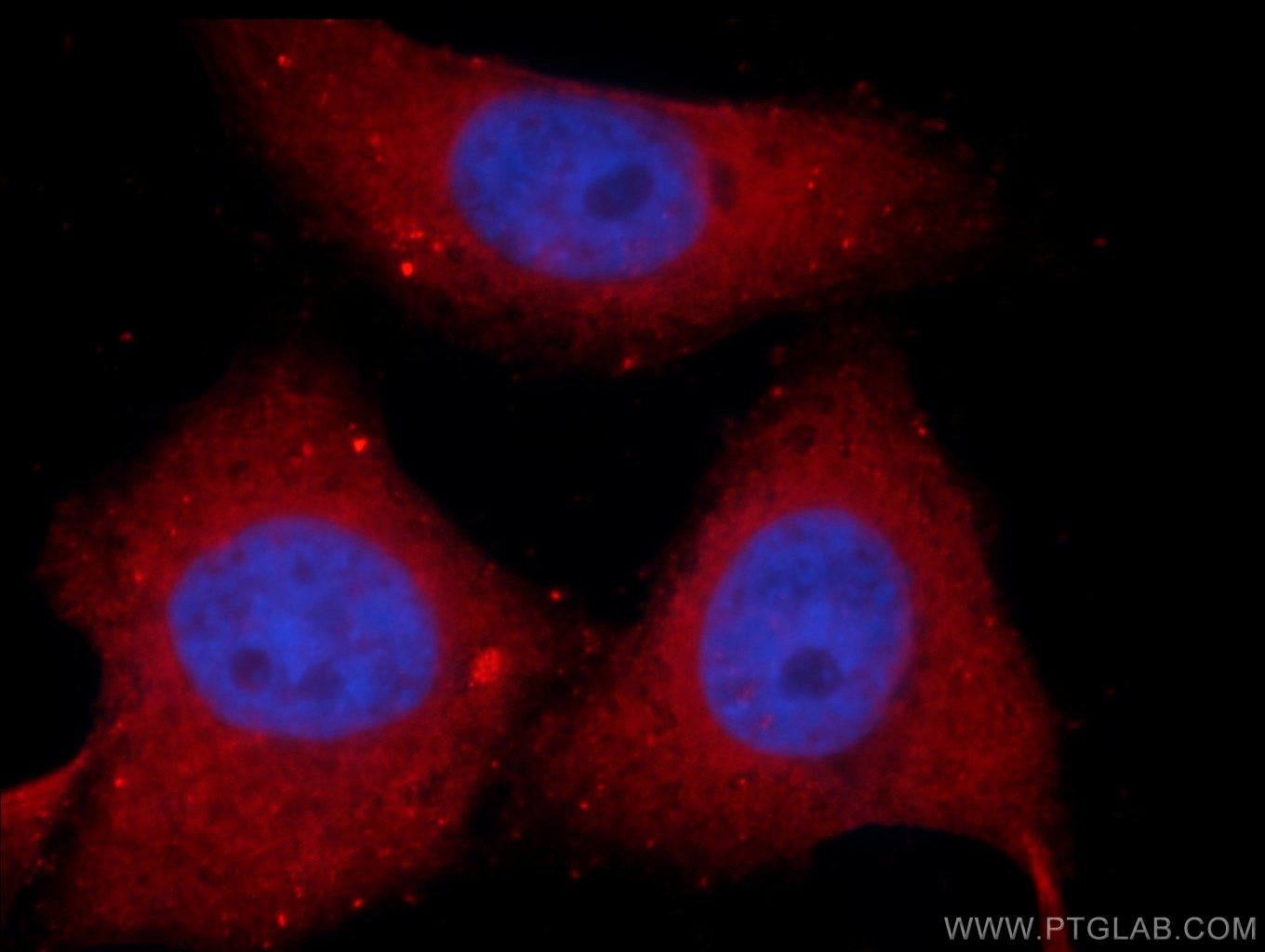 SNX17 Polyclonal antibody