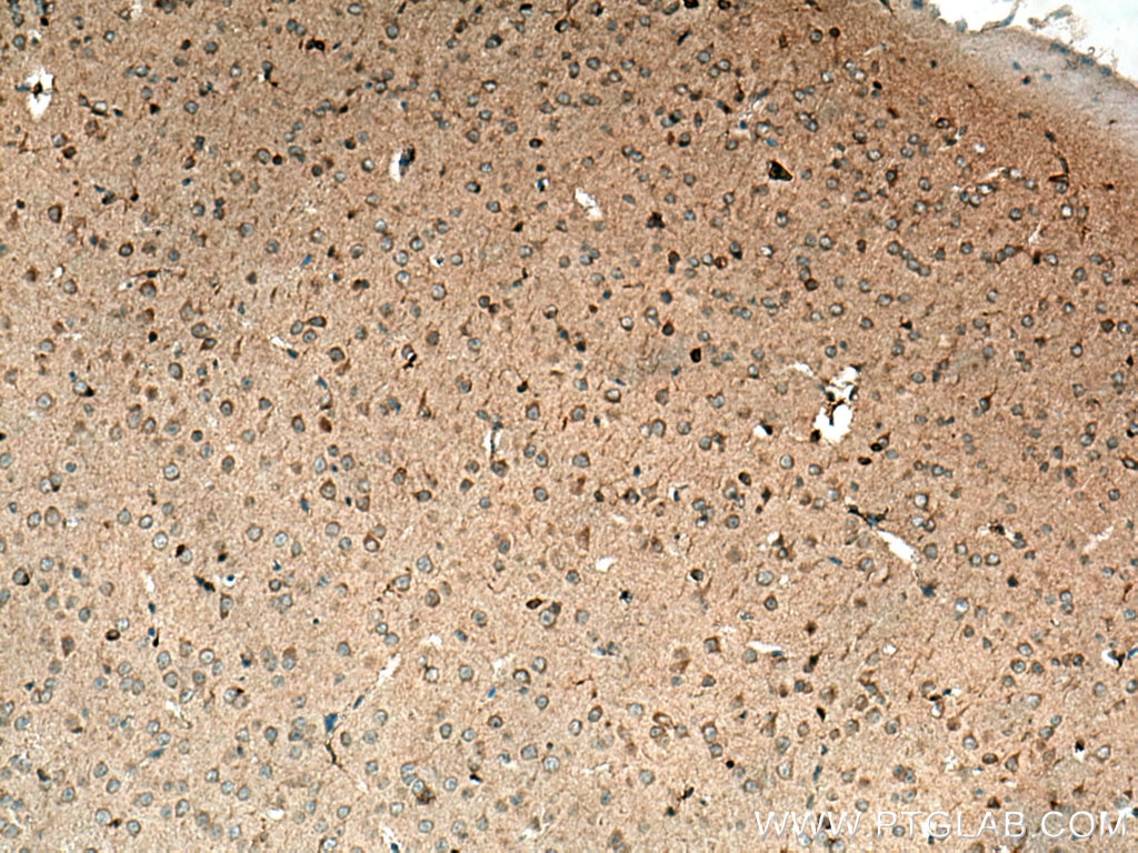Immunohistochemistry (IHC) staining of mouse brain tissue using SNX17 Polyclonal antibody (10275-1-AP)