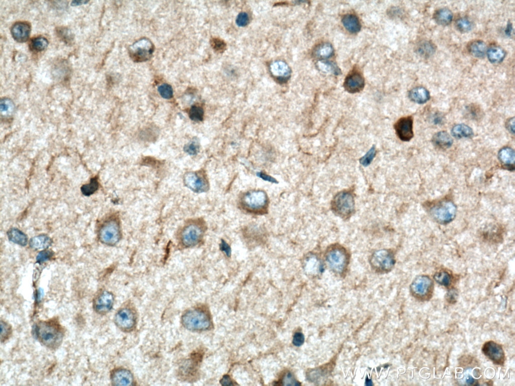 IHC staining of mouse brain using 10275-1-AP