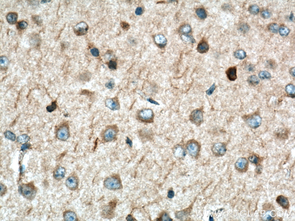 Immunohistochemistry (IHC) staining of mouse brain tissue using SNX17 Polyclonal antibody (10275-1-AP)