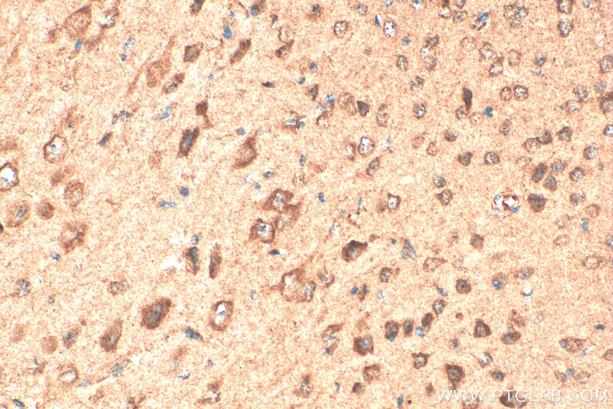 Immunohistochemistry (IHC) staining of mouse brain tissue using SNX17 Polyclonal antibody (10275-1-AP)