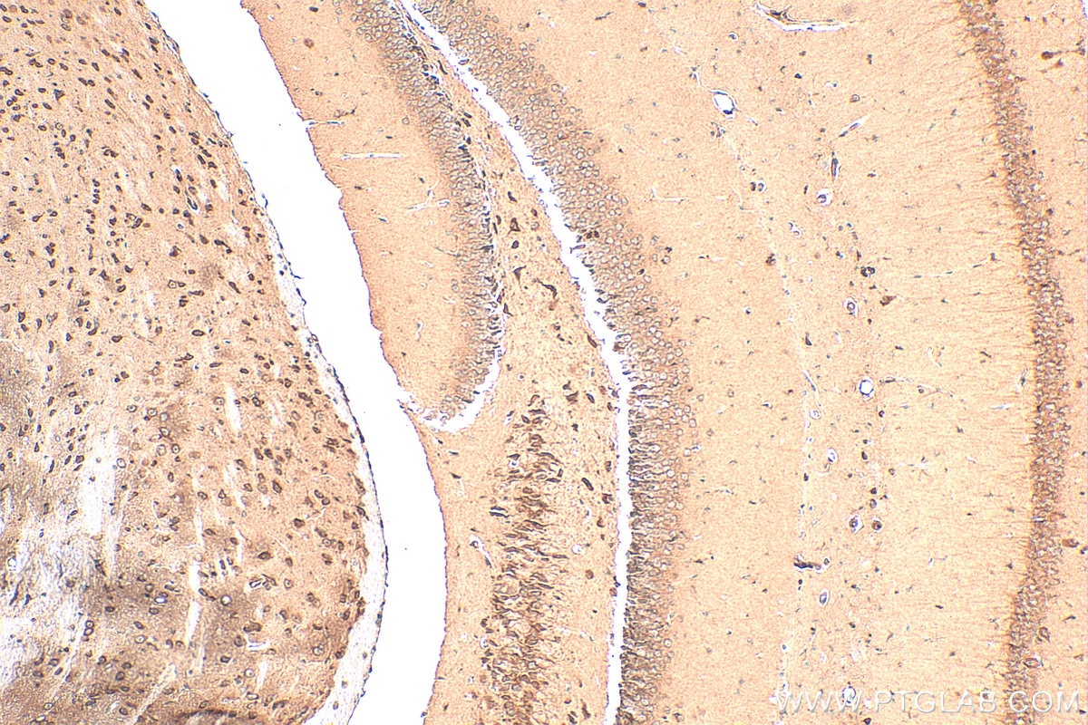 Immunohistochemistry (IHC) staining of mouse brain tissue using SNX17 Polyclonal antibody (10275-1-AP)