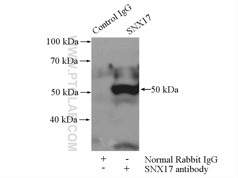 Immunoprecipitation (IP) experiment of HeLa cells using SNX17 Polyclonal antibody (10275-1-AP)