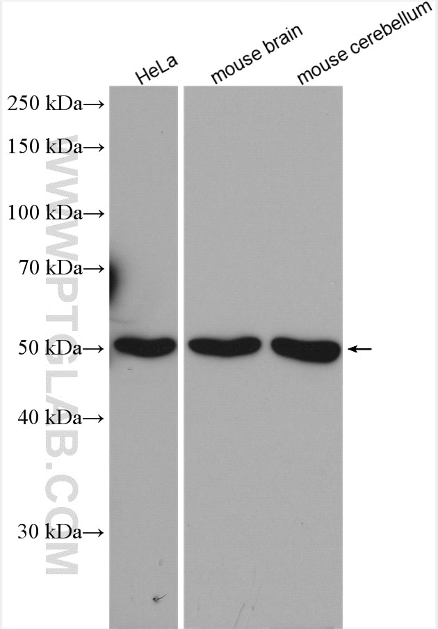 Western Blot (WB) analysis of various lysates using SNX17 Polyclonal antibody (10275-1-AP)