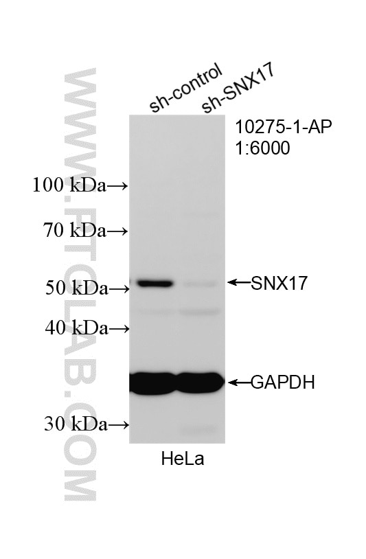 Western Blot (WB) analysis of HeLa cells using SNX17 Polyclonal antibody (10275-1-AP)