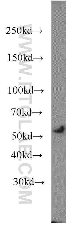 Western Blot (WB) analysis of mouse cerebellum tissue using SNX17 Polyclonal antibody (10275-1-AP)