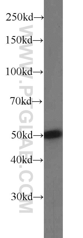 Western Blot (WB) analysis of HeLa cells using SNX17 Polyclonal antibody (10275-1-AP)