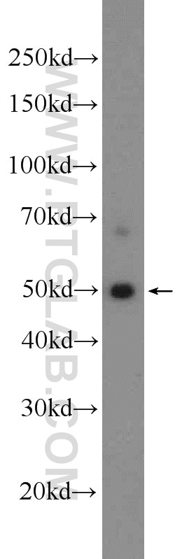 Western Blot (WB) analysis of mouse brain tissue using SNX17 Polyclonal antibody (10275-1-AP)