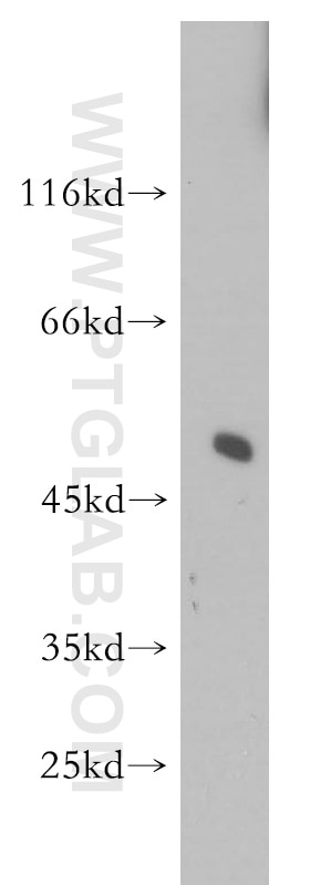 Western Blot (WB) analysis of human brain tissue using SNX17 Polyclonal antibody (10275-1-AP)