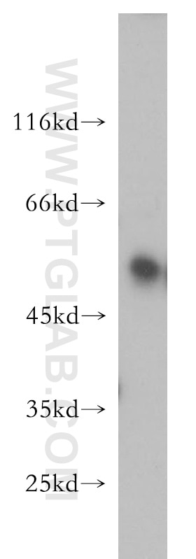 Western Blot (WB) analysis of mouse skin tissue using SNX17 Polyclonal antibody (10275-1-AP)
