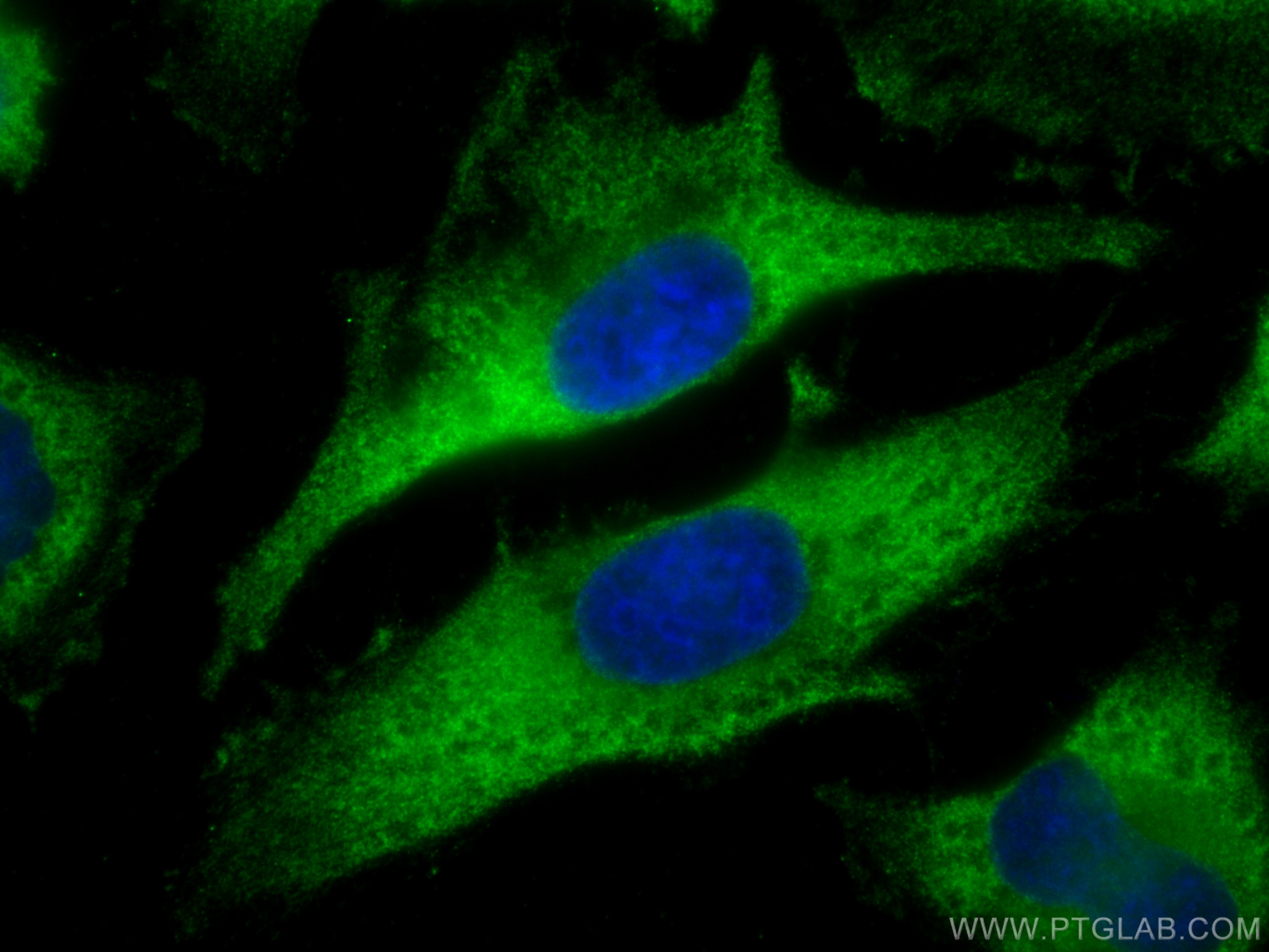 Immunofluorescence (IF) / fluorescent staining of HeLa cells using SNX17 Monoclonal antibody (68256-1-Ig)