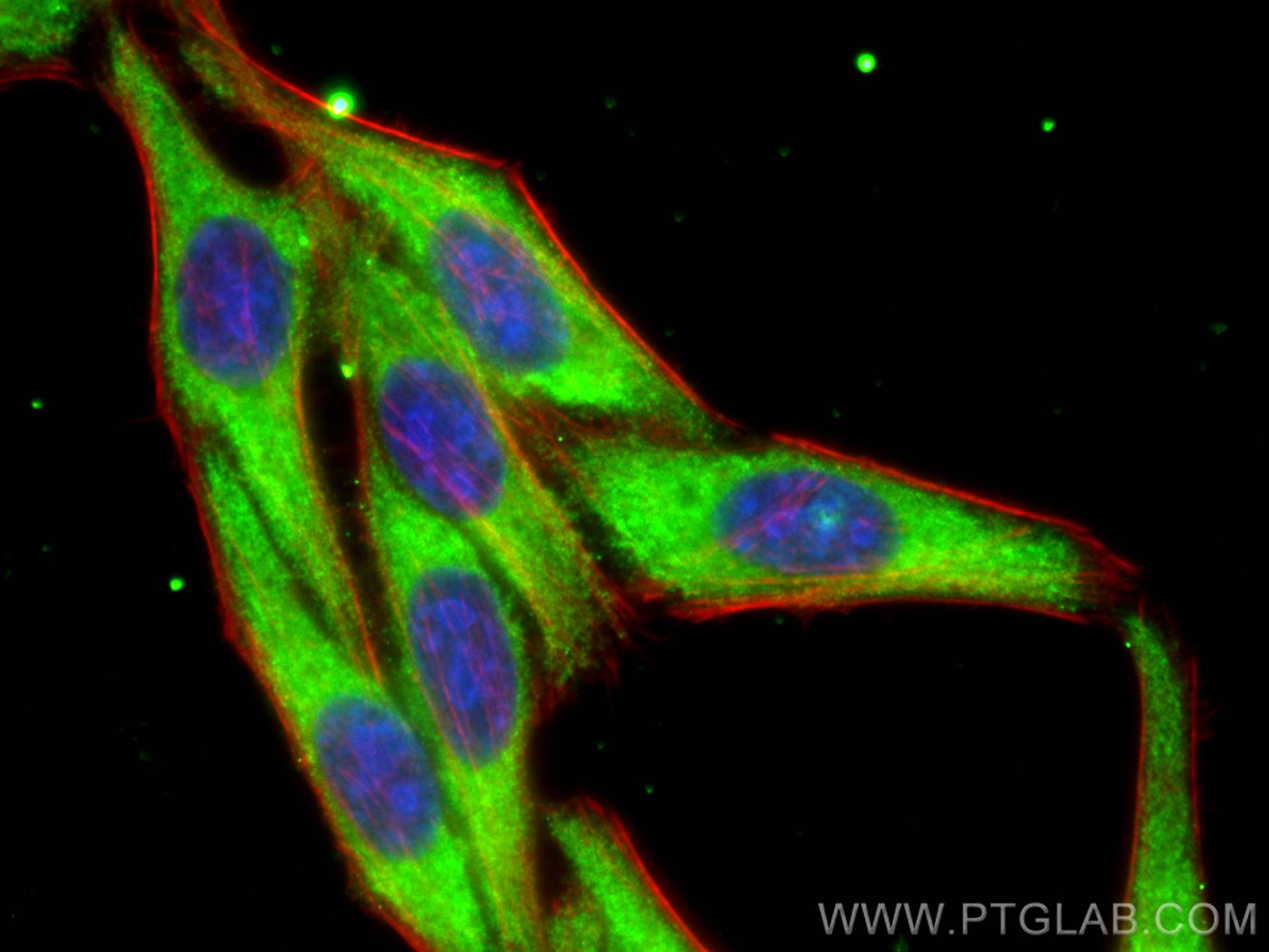 Immunofluorescence (IF) / fluorescent staining of HepG2 cells using SNX17 Monoclonal antibody (68256-1-Ig)