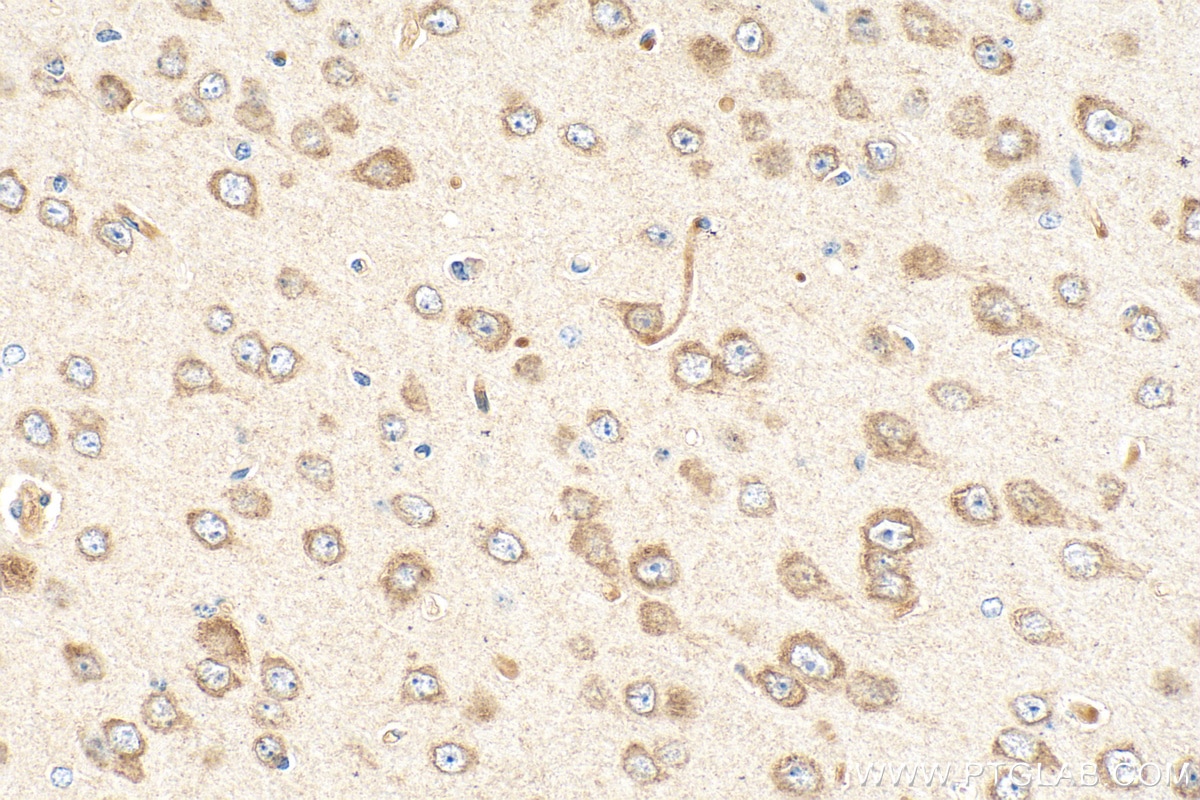 Immunohistochemical analysis of paraffin-embedded mouse brain tissue slide using 68256-1-Ig (SNX17 antibody) at dilution of 1:2000 (under 40x lens). Heat mediated antigen retrieval with Tris-EDTA buffer (pH 9.0). Immunohistochemistry (IHC) staining of mouse brain tissue using SNX17 Monoclonal antibody (68256-1-Ig)