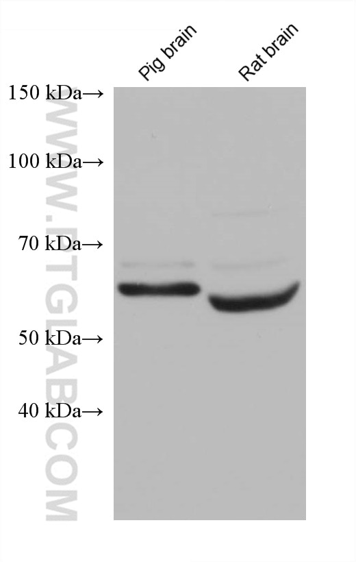 Western Blot (WB) analysis of various lysates using SNX17 Monoclonal antibody (68256-1-Ig)