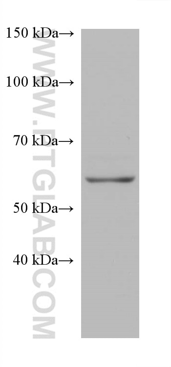 Western Blot (WB) analysis of Jurkat cells using SNX17 Monoclonal antibody (68256-1-Ig)
