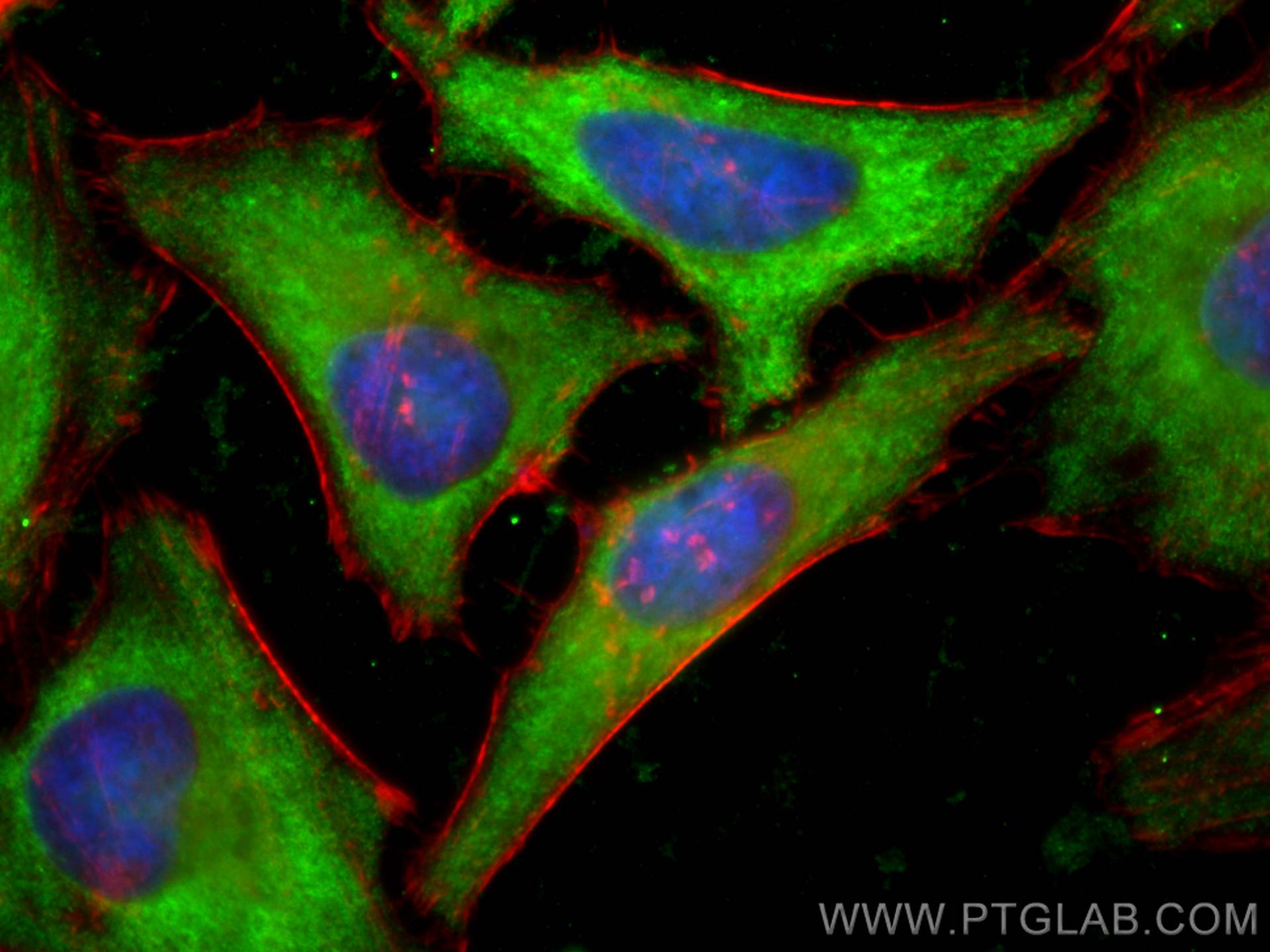 Immunofluorescence (IF) / fluorescent staining of HeLa cells using CoraLite® Plus 488-conjugated SNX17 Monoclonal ant (CL488-68256)