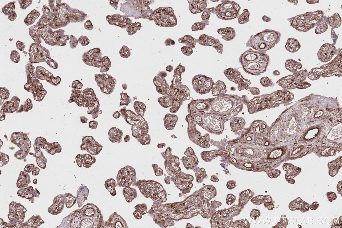 Immunohistochemistry (IHC) staining of human placenta tissue using SNX18 Polyclonal antibody (21946-1-AP)