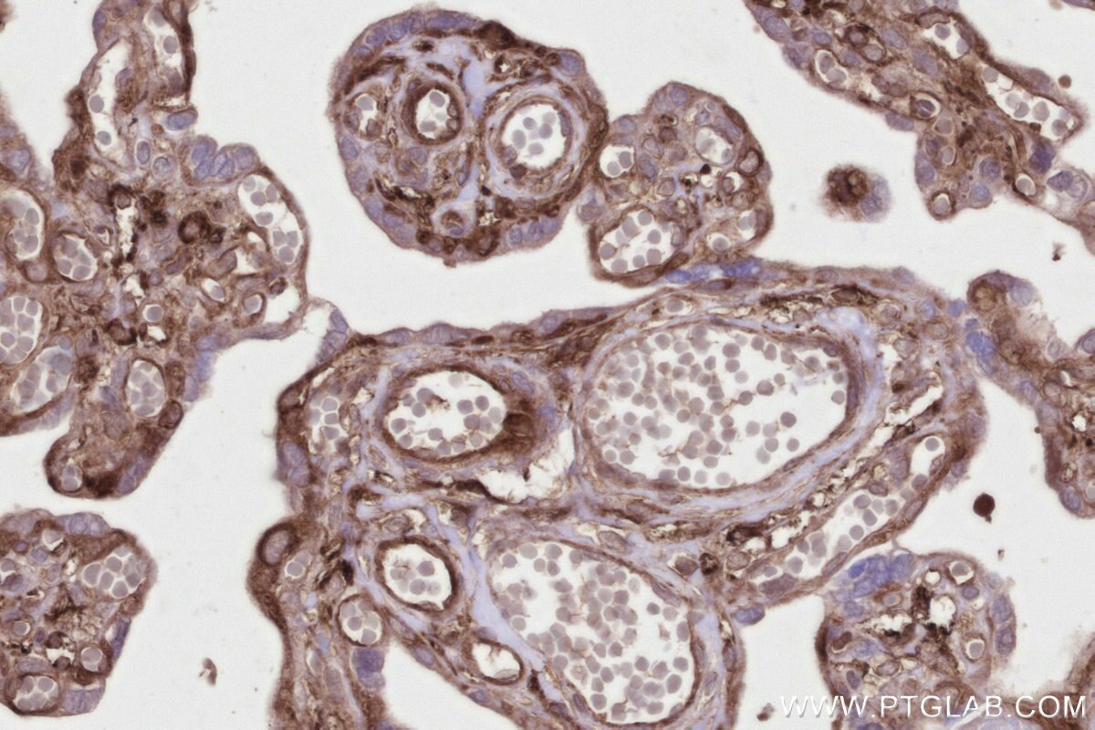 Immunohistochemistry (IHC) staining of human placenta tissue using SNX18 Polyclonal antibody (21946-1-AP)