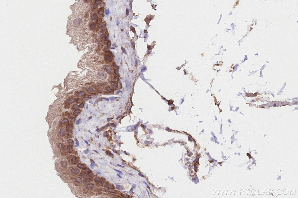 Immunohistochemistry (IHC) staining of mouse bladder tissue using SNX18 Polyclonal antibody (21946-1-AP)