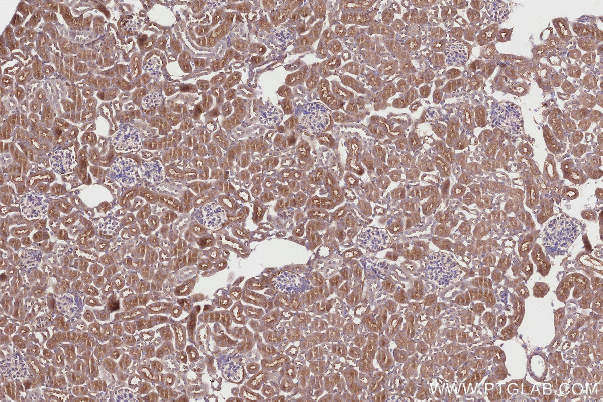 Immunohistochemistry (IHC) staining of mouse kidney tissue using SNX18 Polyclonal antibody (21946-1-AP)