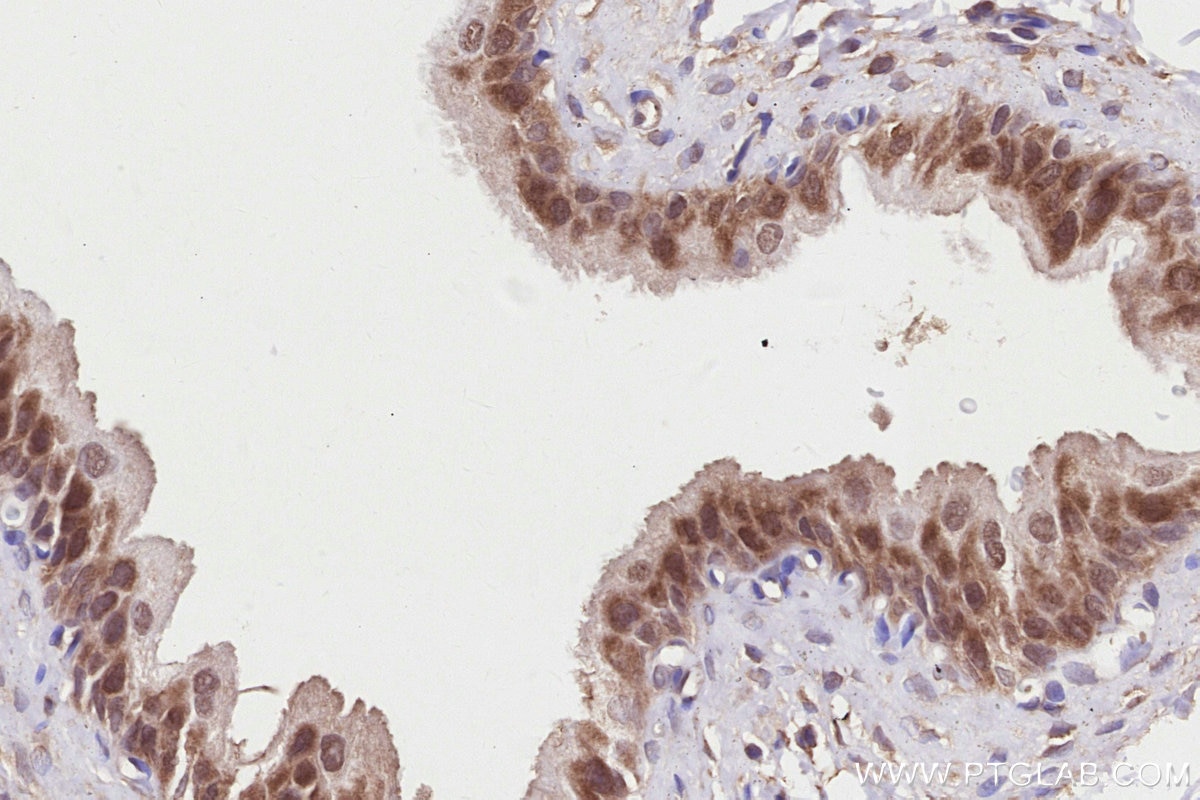 Immunohistochemistry (IHC) staining of rat bladder tissue using SNX18 Polyclonal antibody (21946-1-AP)