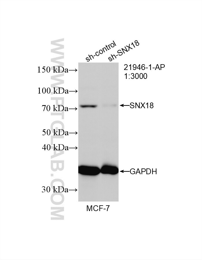 WB result of SNX18 antibody (21946-1-AP; 1:3000; incubated at room temperature for 1.5 hours) with sh-Control and sh-SNX18 transfected MCF-7 cells. Western Blot (WB) analysis of MCF-7 cells using SNX18 Polyclonal antibody (21946-1-AP)