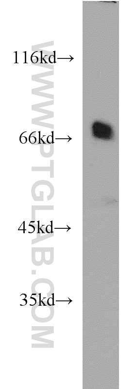 Western Blot (WB) analysis of HL-60 cells using SNX18 Polyclonal antibody (21946-1-AP)