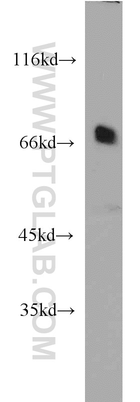 WB analysis of HL-60 using 21946-1-AP