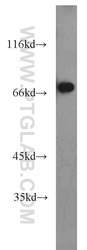 Western Blot (WB) analysis of human placenta tissue using SNX18 Polyclonal antibody (21946-1-AP)
