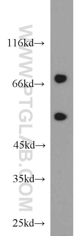Western Blot (WB) analysis of MCF-7 cells using SNX18 Polyclonal antibody (21946-1-AP)