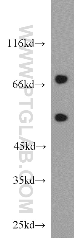 WB analysis of MCF-7 using 21946-1-AP