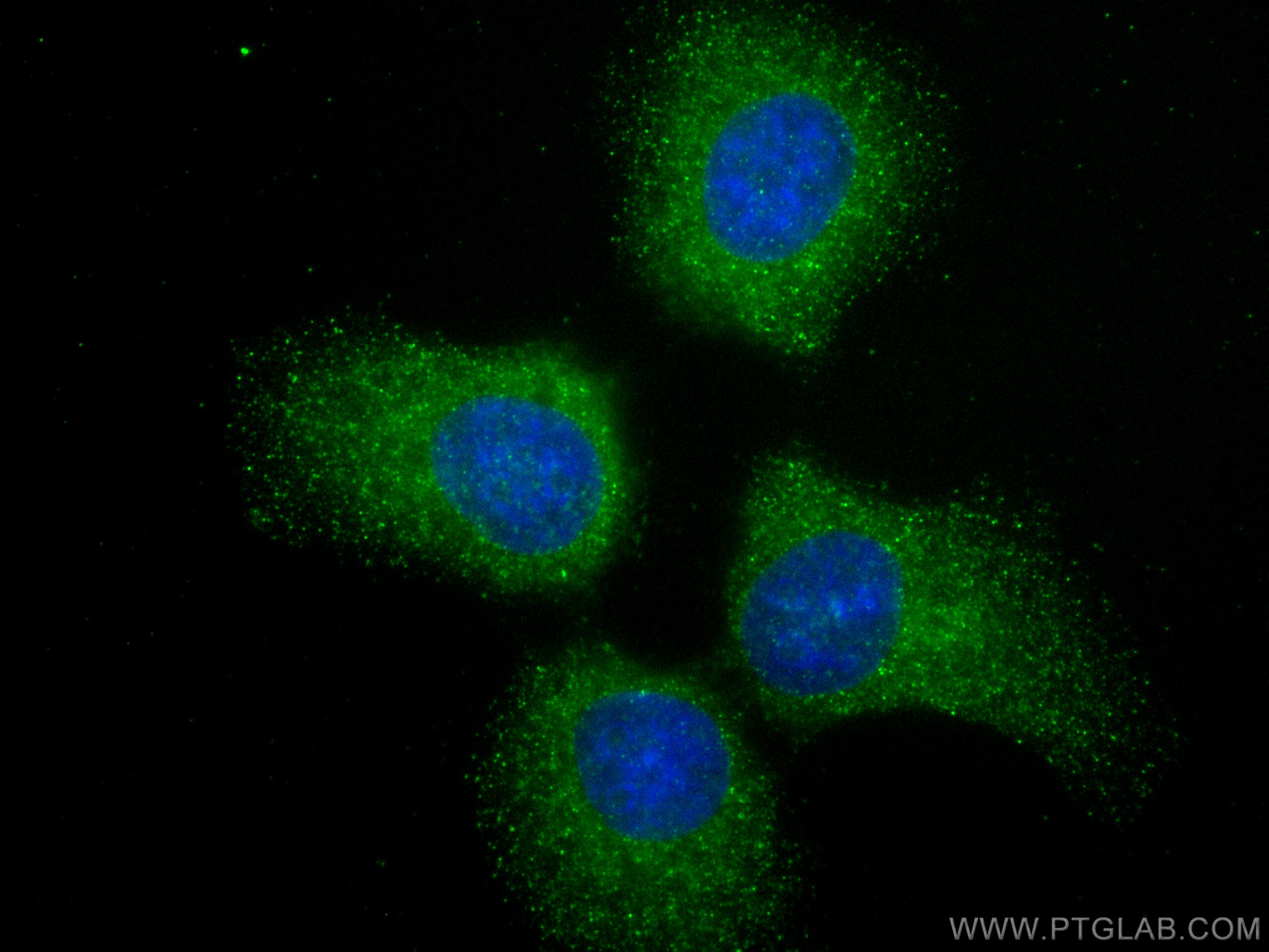 Immunofluorescence (IF) / fluorescent staining of A431 cells using SNX18 Monoclonal antibody (68305-1-Ig)
