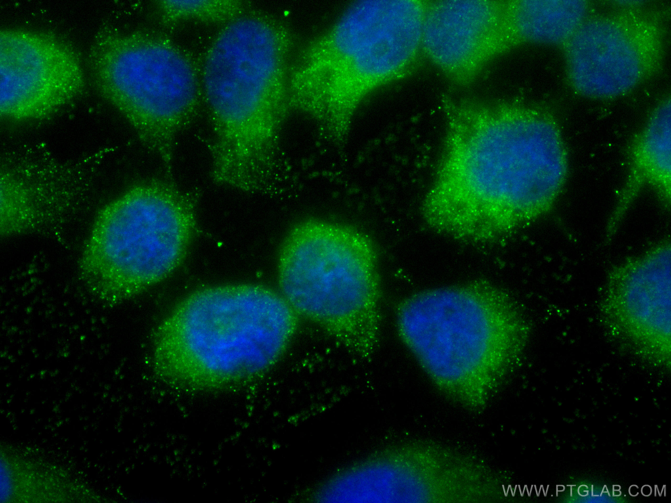 Immunofluorescence (IF) / fluorescent staining of A431 cells using CoraLite® Plus 488-conjugated SNX18 Monoclonal ant (CL488-68305)