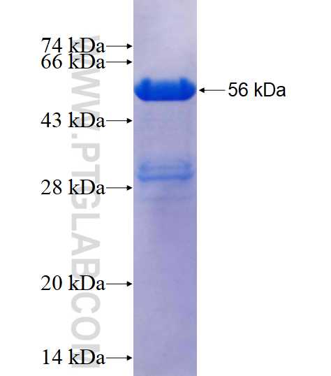 SNX18 fusion protein Ag16645 SDS-PAGE