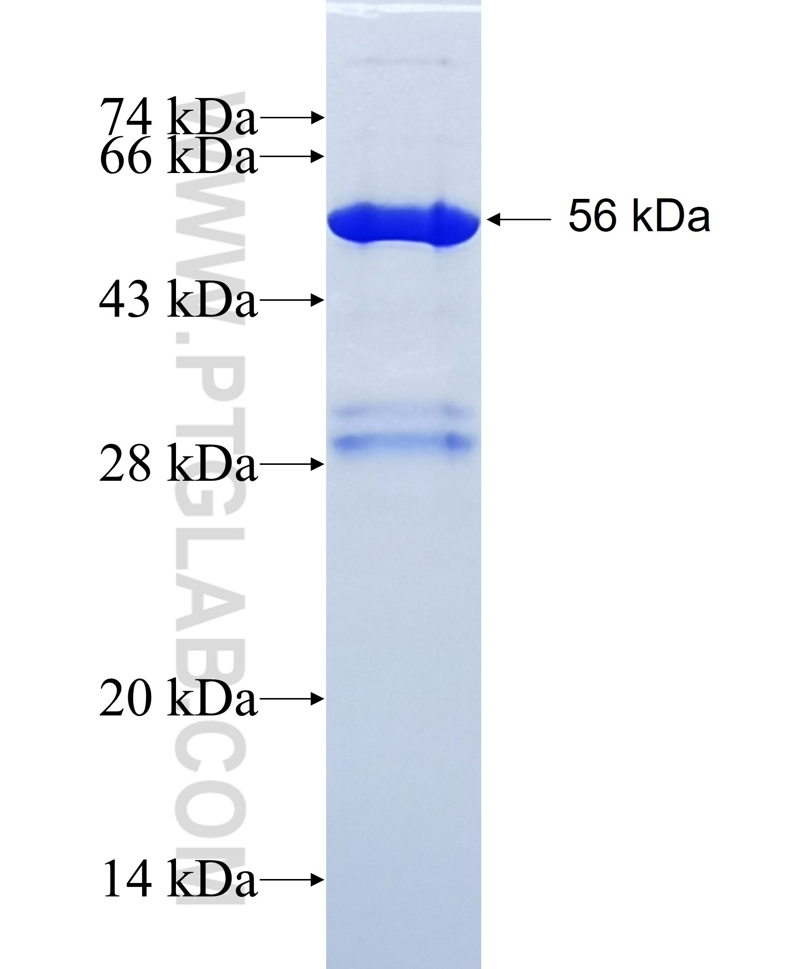 SNX18 fusion protein Ag16645 SDS-PAGE