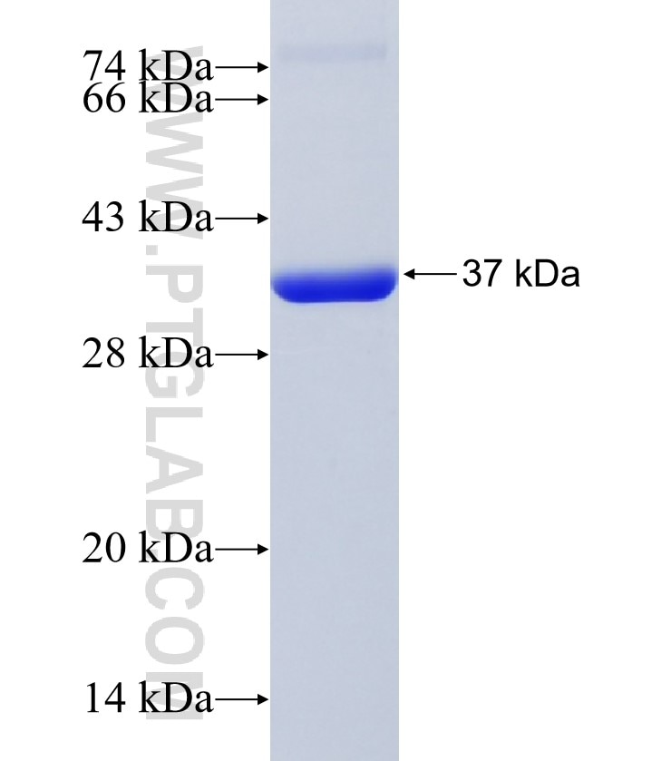 SNX18 fusion protein Ag17388 SDS-PAGE
