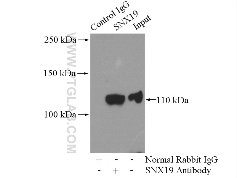 Immunoprecipitation (IP) experiment of Raji cells using SNX19 Polyclonal antibody (13410-1-AP)