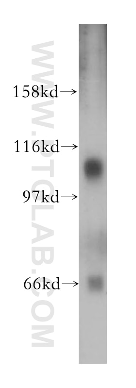 Western Blot (WB) analysis of K-562 cells using SNX19 Polyclonal antibody (13410-1-AP)