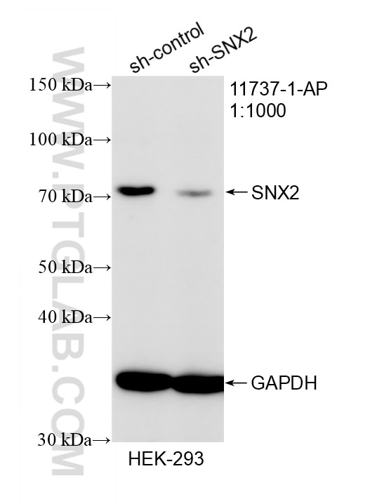 Western Blot (WB) analysis of HEK-293 cells using SNX2 Polyclonal antibody (11737-1-AP)