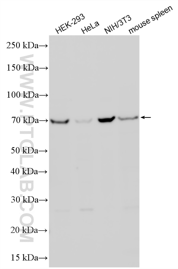 Western Blot (WB) analysis of various lysates using SNX2 Polyclonal antibody (11737-1-AP)