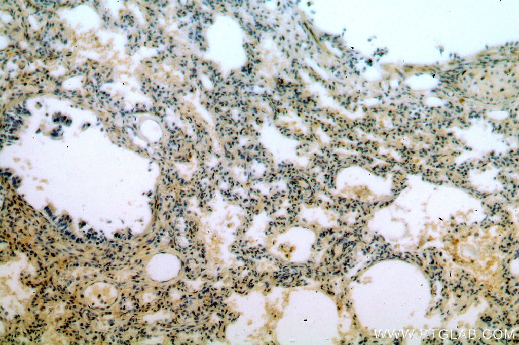 Immunohistochemistry (IHC) staining of human lung tissue using SNX20 Polyclonal antibody (13180-1-AP)