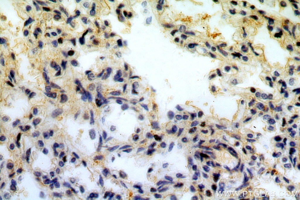 Immunohistochemistry (IHC) staining of human lung tissue using SNX20 Polyclonal antibody (13180-1-AP)